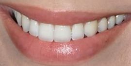 Margot Robbie's teeth