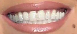 Mariah Carey's teeth and smile