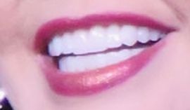 Picture of Marie Osmond teeth and smile