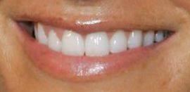 Picture of Marisa Miller teeth and smile