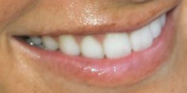 Picture of Marisa Miller teeth and smile