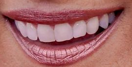 Picture of Marlee Matlin teeth and smile