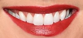 Picture of Martha Hunt teeth and smile