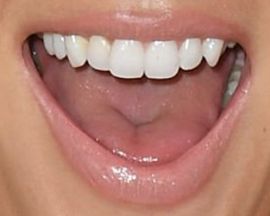 Picture of Martha Hunt teeth and smile