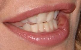 Picture of Meg Ryan teeth and smile