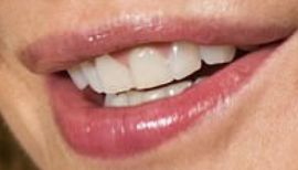 Picture of Meg Ryan teeth and smile