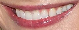 Picture of Meghan King Edmonds teeth and smile