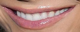 Picture of Meghan King Edmonds teeth and smile