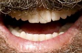 Picture of Mel Gibson healthy teeth and smile