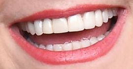 Picture of Melissa Joan Hart teeth and smile
