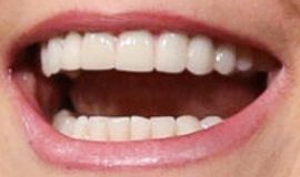 Picture of Melissa Joan Hart teeth and smile