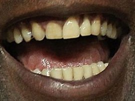 Picture of Michael Jordan teeth and smile