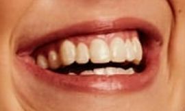Picture of Millie Bobby Brown teeth and smile