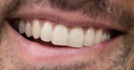 Picture of Milo Ventimiglia teeth and smile