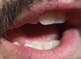 Picture of Milo Ventimiglia teeth and smile