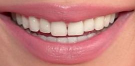 Picture of Miranda Cosgrove teeth and smile