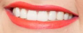 Miranda Lambert teeth