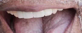 Picture of Morgan Freeman teeth and smile
