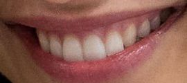 Picture of Naomi Scott teeth and smile
