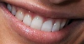 Picture of Naomi Scott teeth and smile