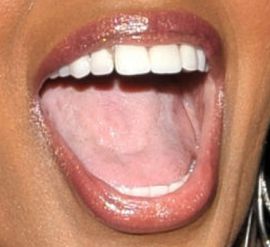 Picture of NeNe Leakes teeth and smile