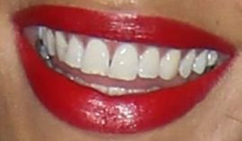 Picture of Noemie Lenoir teeth and smile