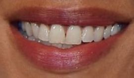 Picture of Noemie Lenoir teeth and smile