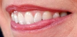 Picture of Olivia Colman teeth and smile