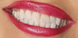 Picture of Pamela Anderson teeth and smile