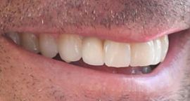 Picture of Patrick Dempsey teeth and smile