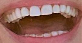Picture of Paulina Porizkova teeth and smile