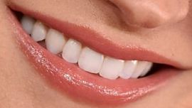Picture of Rachael Leigh Cook teeth and smile