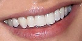 Picture of Rachael Leigh Cook teeth and smile