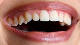 Picture of Rachel Zegler teeth and smile