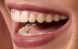 Picture of Rachel Zegler teeth and smile
