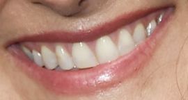 Picture of Ricki Lake teeth and smile