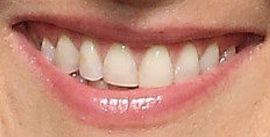 Picture of Ricki Lake teeth and smile