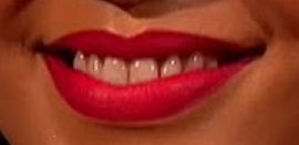 Picture of Rihanna teeth and smile