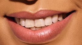 Picture of Rihanna teeth and smile