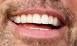 Picture of Rob McElhenney teeth and smile