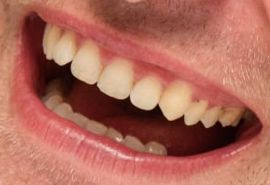 Picture of Robert Pattinson healthy teeth and smile