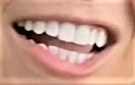 Picture of Ronda Rousey teeth and smile