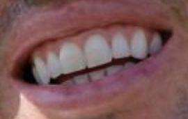Picture of Rory McIlroy teeth and smile