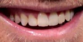 Picture of Ryan Gosling teeth and smile
