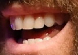 Picture of Ryan Reynolds teeth and smile