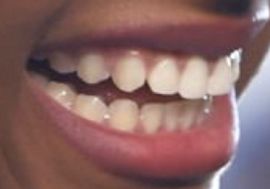 Picture of Saniyya Sidney teeth and smile