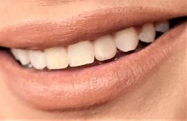 Picture of Sarah Hyland teeth and smile