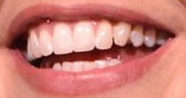 Picture of Sarah Michelle Gellar teeth and smile