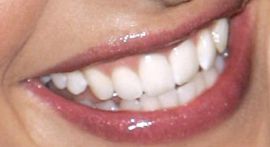 Picture of Sarah Michelle Gellar teeth and smile