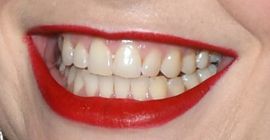 Picture of Sarah Snook teeth smile